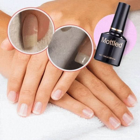 🎉Koop 2, krijg 1 gratis💅Hoogtransparante 3-in-1 multifunctionele nagelherstelgel